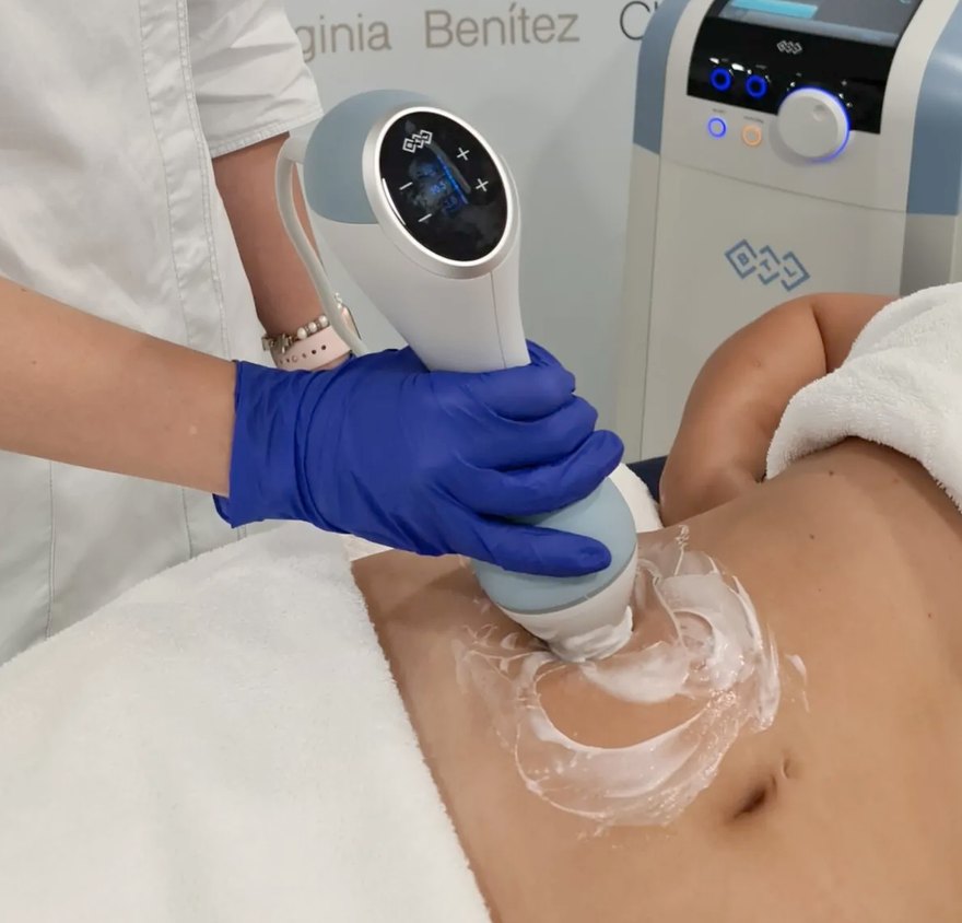 Tratamiento corporal con criolipólisis en Benroig