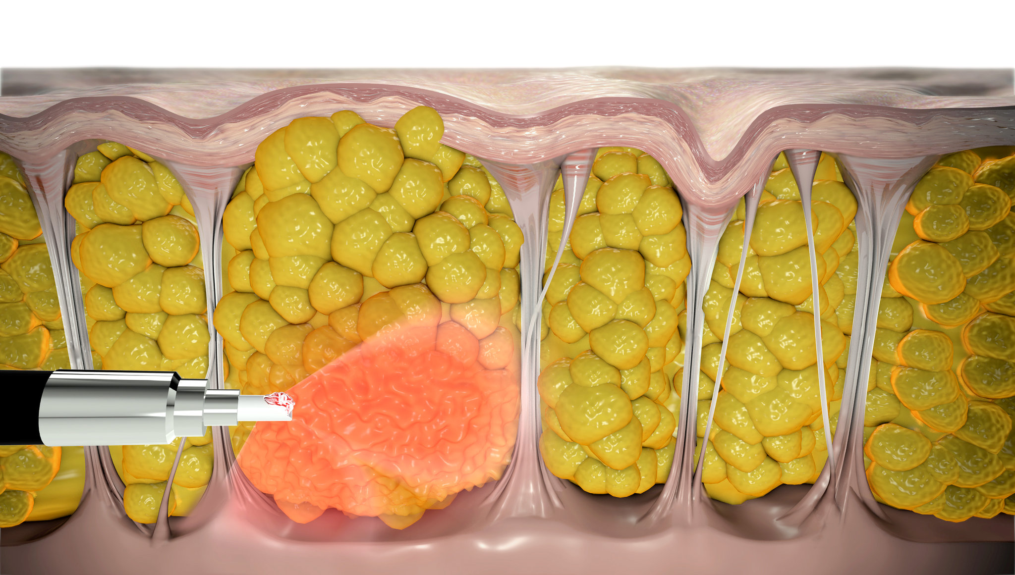 Cellulaze®