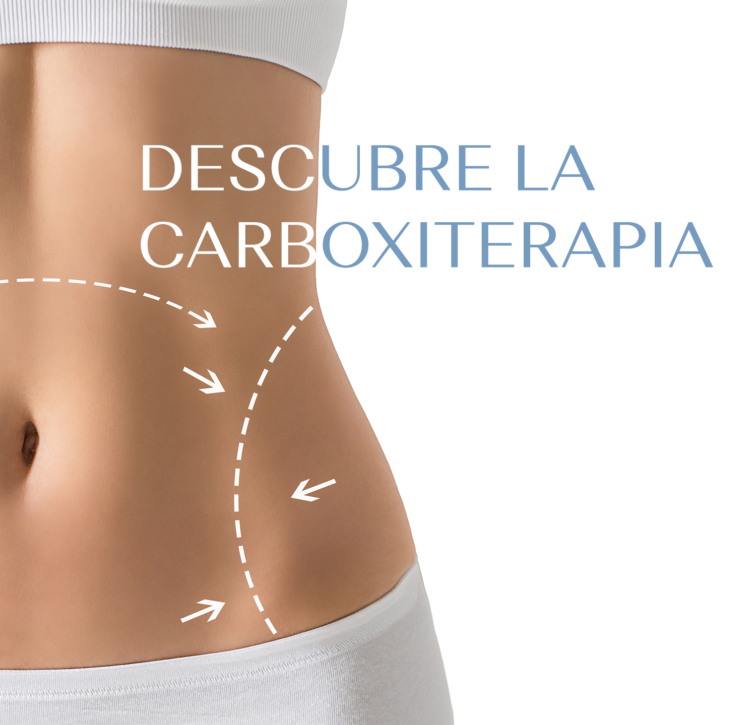 Carboxiterapia