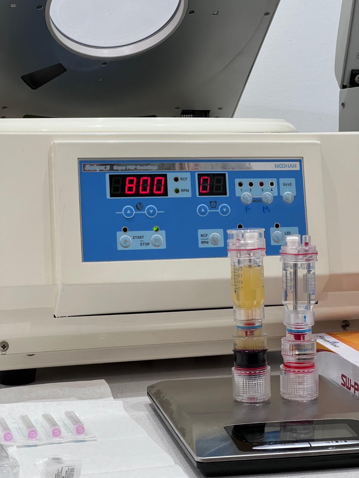 Plasma rico en plaquetas (PRP)